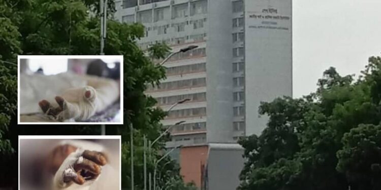 সিদ্ধিরগঞ্জে ড্রিল মেশিন বিস্ফোরণ : দগ্ধ ২