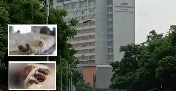 রূপগঞ্জে গ্যাস বিস্ফোরণ, স্বামী স্ত্রী দগ্ধ