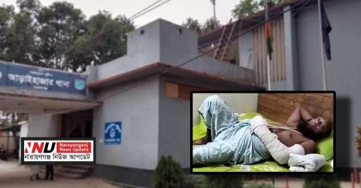 স্বরাষ্ট্র উপদেষ্টার মন্তব্য : এবার দুই বাড়ীতে ডাকাতি, আহত -১