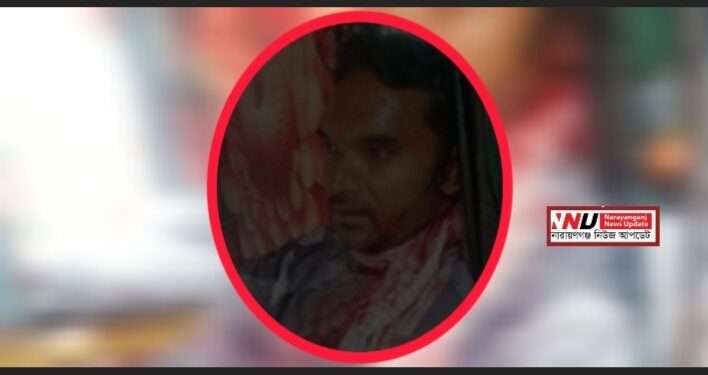 ফতুল্লায় যাত্রীবেশে অটোরিকশা চালককে গলা কেটে হত্যাচেষ্টা