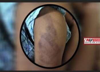শিক্ষকের হাতে শিক্ষার্থী নির্যাতন : বিচার চেয়ে ক্ষুব্ধ অভিভাবক