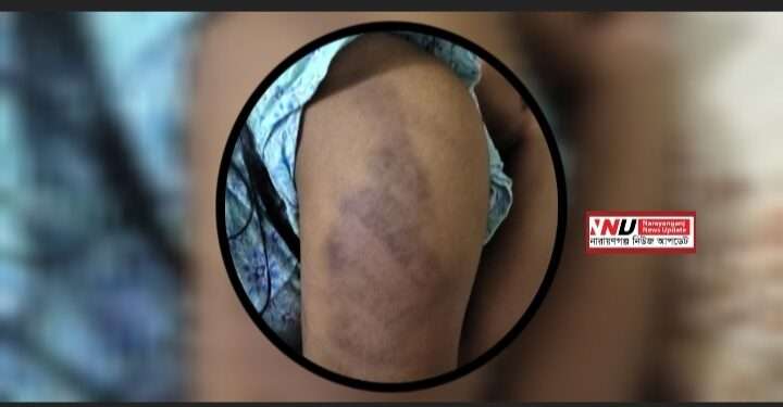 শিক্ষকের হাতে শিক্ষার্থী নির্যাতন : বিচার চেয়ে ক্ষুব্ধ অভিভাবক